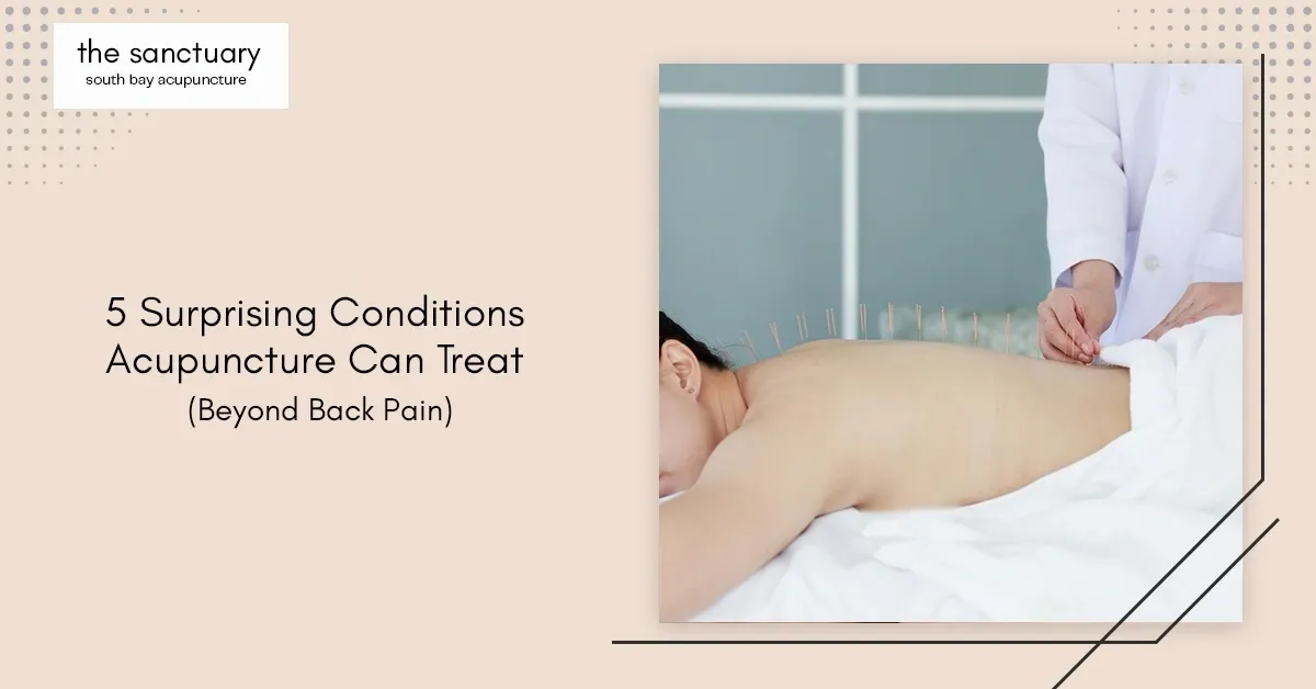5 Surprising Conditions Acupuncture Can Treat (Beyond Back Pain)