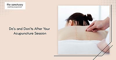 Dos and Don'ts After Your Acupuncture Session