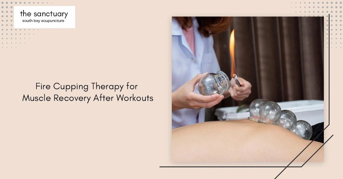 Fire Cupping Therapy for Muscle Recovery After Workouts