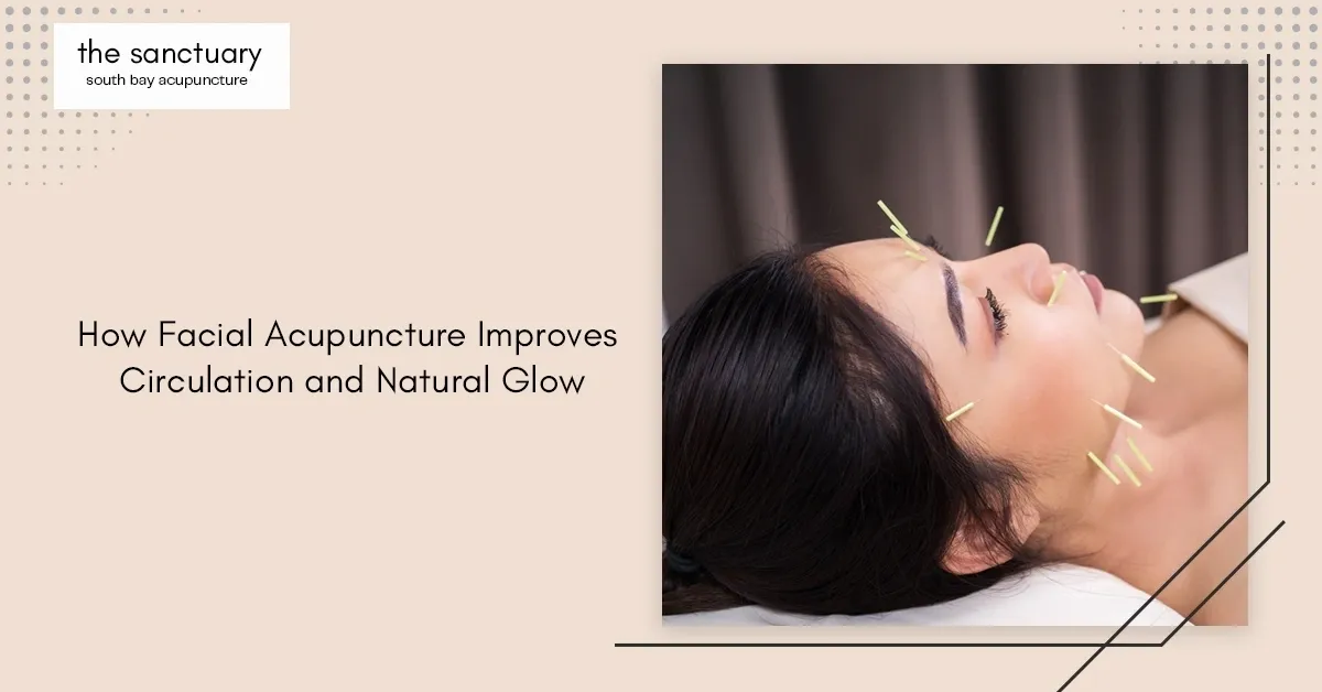 How Facial Acupuncture Improves Circulation and Natural Glow