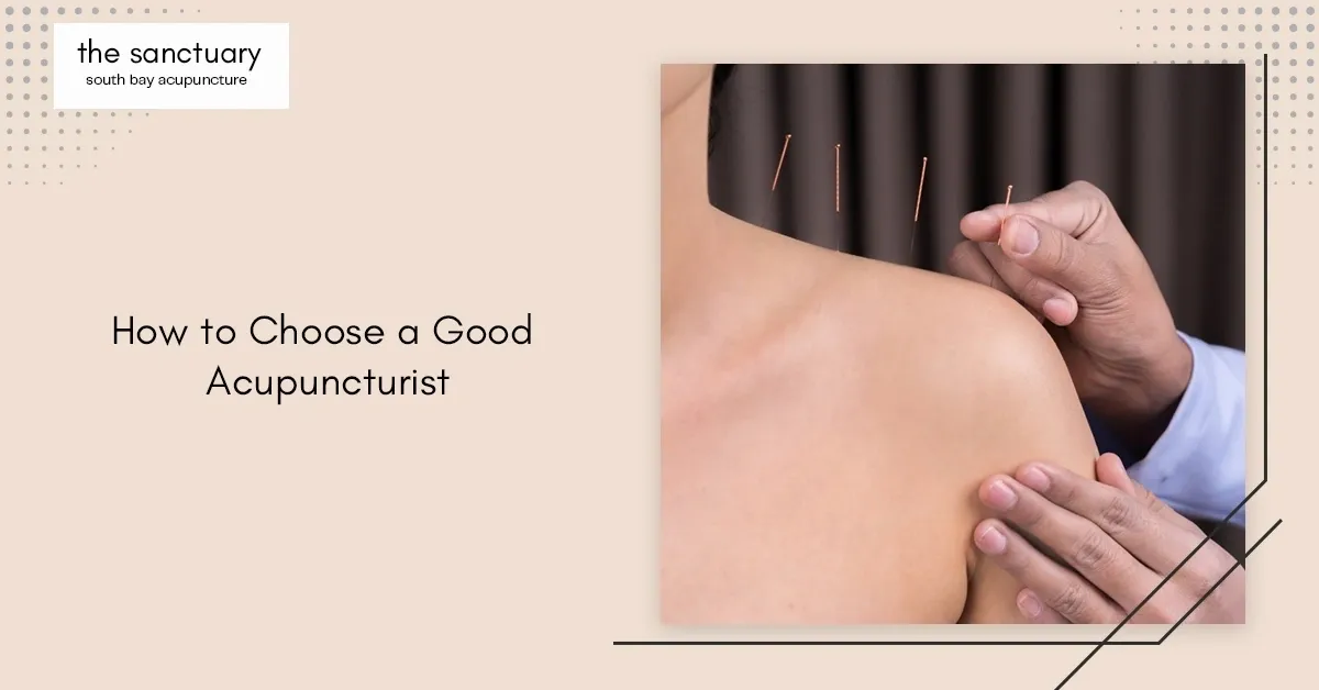 How to Choose a Good Acupuncturist